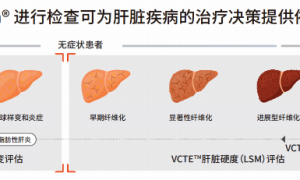 肝病诊断技术革新者——深圳回波（Echosens中国）推出全新版FibroScan® Pro